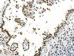 Phospho-ABI1 (Tyr213) Antibody in Immunohistochemistry (Paraffin) (IHC (P))