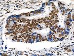 Phospho-ABI1 (Tyr213) Antibody in Immunohistochemistry (Paraffin) (IHC (P))