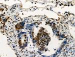 Phospho-ABI1 (Tyr213) Antibody in Immunohistochemistry (Paraffin) (IHC (P))