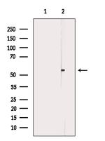 Phospho-ABI1 (Tyr213) Antibody in Western Blot (WB)