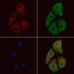 Phospho-CDK5 (Ser159) Antibody in Immunocytochemistry (ICC/IF)