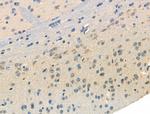 Phospho-GABBR2 (Ser884) Antibody in Immunohistochemistry (Paraffin) (IHC (P))