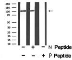 Phospho-GABBR2 (Ser884) Antibody in Western Blot (WB)