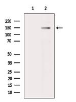 Phospho-IRS2 (Ser1100) Antibody in Western Blot (WB)