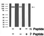 Phospho-TRKB (Tyr817) Antibody in Western Blot (WB)