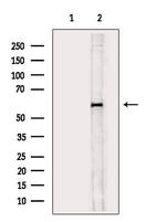 Phospho-CEACAM1 (Ser508) Antibody in Western Blot (WB)