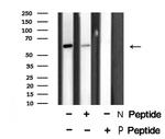 Phospho-DRP1 (Thr509) Antibody in Western Blot (WB)