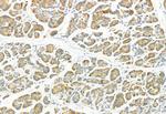 Phospho-FGFR2 (Ser782) Antibody in Immunohistochemistry (Paraffin) (IHC (P))