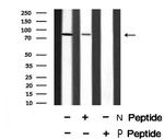 Phospho-FGFR2 (Ser782) Antibody in Western Blot (WB)