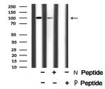 Phospho-ROR1 (Tyr786) Antibody in Western Blot (WB)