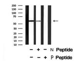 Phospho-TGFBR1 (Thr204) Antibody in Western Blot (WB)