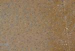 Phospho-TGFBR1 (Thr204) Antibody in Immunohistochemistry (Paraffin) (IHC (P))