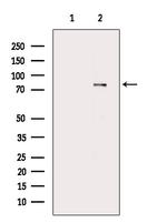 Phospho-DNM1L (Ser616) Antibody in Western Blot (WB)