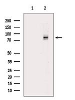 Phospho-DNM1L (Ser616) Antibody in Western Blot (WB)