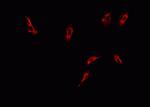 Phospho-DNM1L (Ser616) Antibody in Immunocytochemistry (ICC/IF)