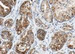 Phospho-DNM1L (Ser616) Antibody in Immunohistochemistry (Paraffin) (IHC (P))