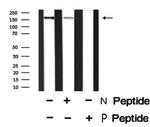 Phospho-FANCD2 (Thr691) Antibody in Western Blot (WB)