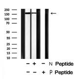 Phospho-GP130 (Tyr759) Antibody in Western Blot (WB)