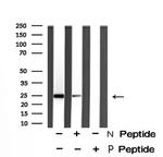 Phospho-HP1 beta (Thr51) Antibody in Western Blot (WB)