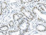 Phospho-INCENP (Thr59) Antibody in Immunohistochemistry (Paraffin) (IHC (P))