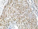 Phospho-INCENP (Thr59) Antibody in Immunohistochemistry (Paraffin) (IHC (P))