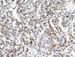 Phospho-INCENP (Thr59) Antibody in Immunohistochemistry (Paraffin) (IHC (P))