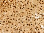 Phospho-INCENP (Thr59) Antibody in Immunohistochemistry (Paraffin) (IHC (P))