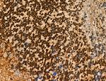 Phospho-INCENP (Thr59) Antibody in Immunohistochemistry (Paraffin) (IHC (P))