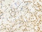 Phospho-INCENP (Thr59) Antibody in Immunohistochemistry (Paraffin) (IHC (P))