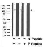 Phospho-INCENP (Thr59) Antibody in Western Blot (WB)