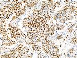 Phospho-MCM2 (Ser139) Antibody in Immunohistochemistry (Paraffin) (IHC (P))