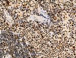 Phospho-MCM2 (Ser139) Antibody in Immunohistochemistry (Paraffin) (IHC (P))