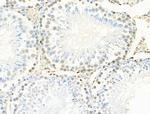 Phospho-MCM2 (Ser139) Antibody in Immunohistochemistry (Paraffin) (IHC (P))