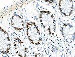 Phospho-MCM2 (Ser139) Antibody in Immunohistochemistry (Paraffin) (IHC (P))