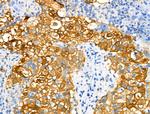 Phospho-NDRG1 (Ser330) Antibody in Immunohistochemistry (Paraffin) (IHC (P))