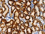 Phospho-NDRG1 (Ser330) Antibody in Immunohistochemistry (Paraffin) (IHC (P))