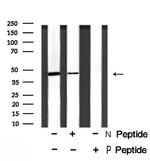 Phospho-NDRG1 (Ser330) Antibody in Western Blot (WB)