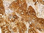 Phospho-NDRG1 (Thr346) Antibody in Immunohistochemistry (Paraffin) (IHC (P))