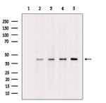 Phospho-PDHA1/PDHA2 (Ser293, Ser291) Antibody in Western Blot (WB)