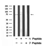 Phospho-Torc1 (Ser151) Antibody in Western Blot (WB)