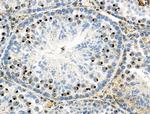 Phospho-Trf2 (Ser365) Antibody in Immunohistochemistry (Paraffin) (IHC (P))