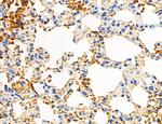 Phospho-Axl (Tyr702) Antibody in Immunohistochemistry (Paraffin) (IHC (P))