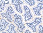 Phospho-Axl (Tyr702) Antibody in Immunohistochemistry (Paraffin) (IHC (P))