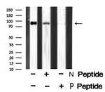 Phospho-Axl (Tyr702) Antibody in Western Blot (WB)