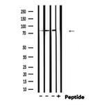 Phospho-EZH2 (Thr367) Antibody in Western Blot (WB)