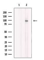 MARK Pan Antibody in Western Blot (WB)