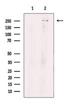 ROS1 Antibody in Western Blot (WB)