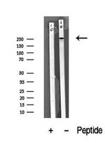 ROS1 Antibody in Western Blot (WB)