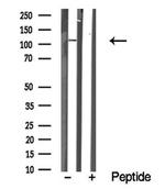 MERTK Antibody in Western Blot (WB)