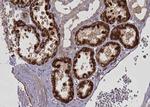 CPT1A Antibody in Immunohistochemistry (Paraffin) (IHC (P))